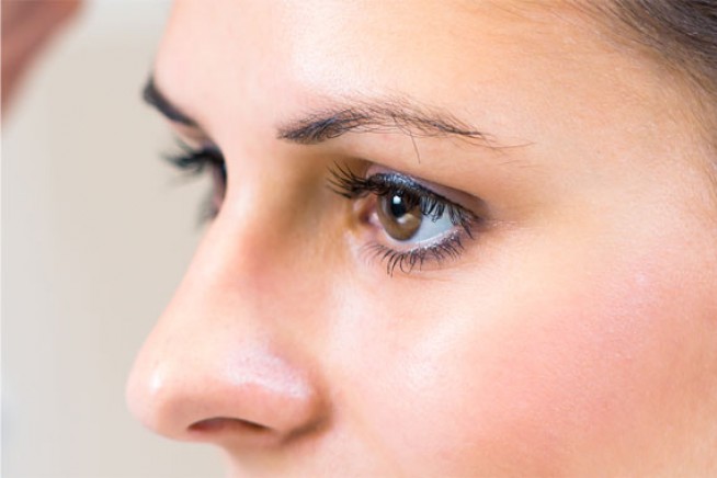 Glaucoma